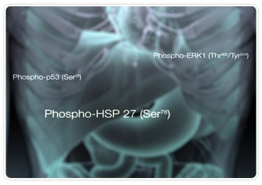 Recent research is uncovering cytokine, chemokine, and phosphoprotein signatures that seem to have the potential to help target treatments and therapies for diseases like leukemia.