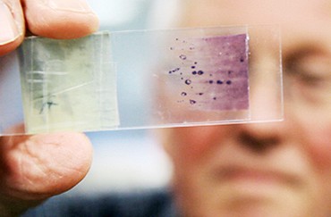 Alec Morley examining a bone marrow section