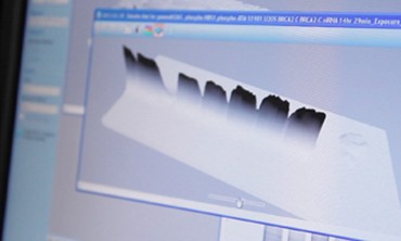 Protein gel image analysis using Image Lab software