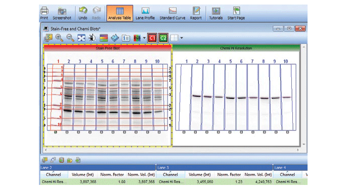 Total protein normalization calculations using specialized software in stain free-enabled imagers.