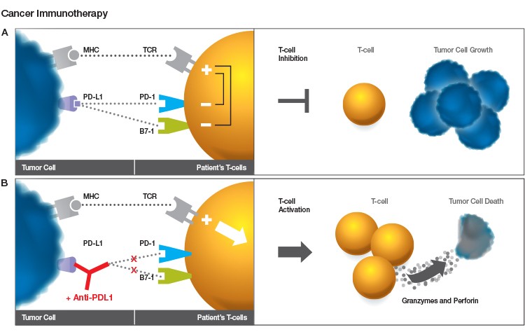 cancer-immunotherapy-image