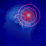 Novel Biomarkers for Traumatic Brain Injury