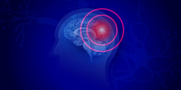 Novel Biomarkers for Traumatic Brain Injury