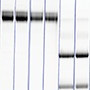 Fig. 3. Gels representing IgG recovery.