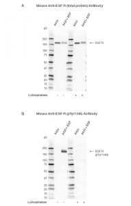 Fig. 1. Western blot analysis of A431-untreated and EGF-treated whole cell lysates probed with (A) Mouse Anti-EGF R Antibody (catalog #VMA00061) or (B) Mouse Anti-EGF R (pTyr1148) Antibody (#VMA00751) followed by detection with HRP-conjugated Goat Anti-Mouse IgG (1:10,000, #STAR207P).