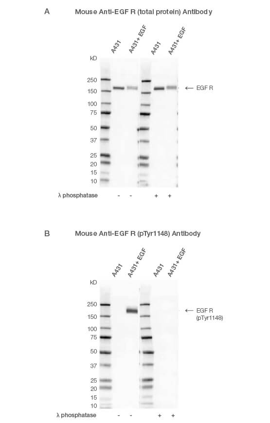 Fig. 1. Western blot analysis of A431-untreated and EGF-treated whole cell lysates probed with (A) Mouse Anti-EGF R Antibody (catalog #VMA00061) or (B) Mouse Anti-EGF R (pTyr1148) Antibody (#VMA00751) followed by detection with HRP-conjugated Goat Anti-Mouse IgG (1:10,000, #STAR207P).